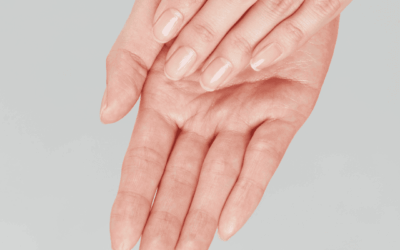 Cómo fortalecer uñas quebradizas de forma natural y efectiva